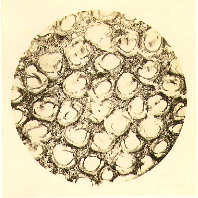 Photo Detail - Adolphe Bertsch - Biological Microscope Study